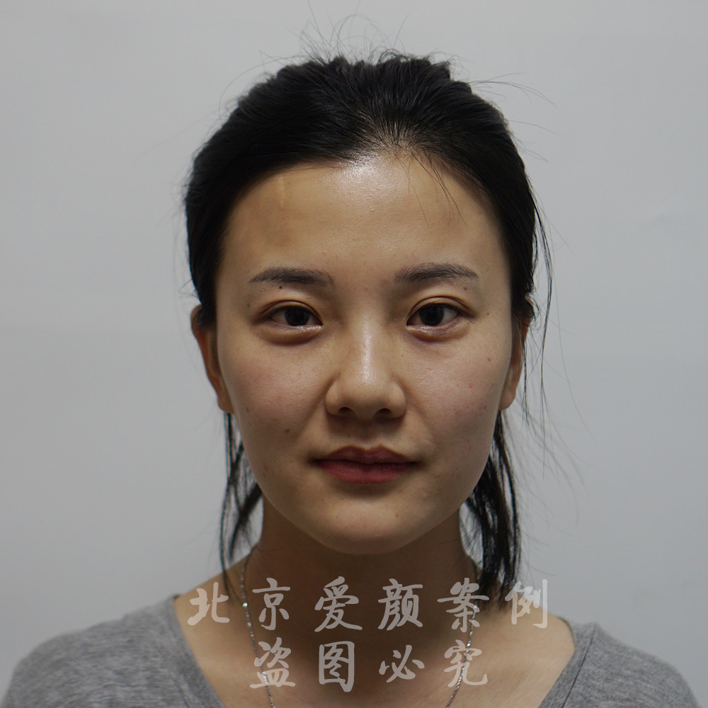 足球赌注软件APP